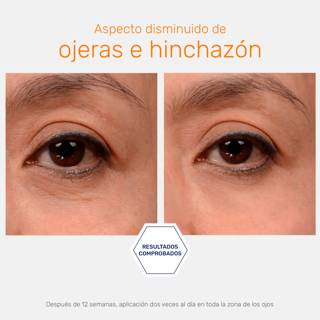 Brightening Eye Cream - Crema Corrección de ojeras hiperpigmentadas y antiarrugas