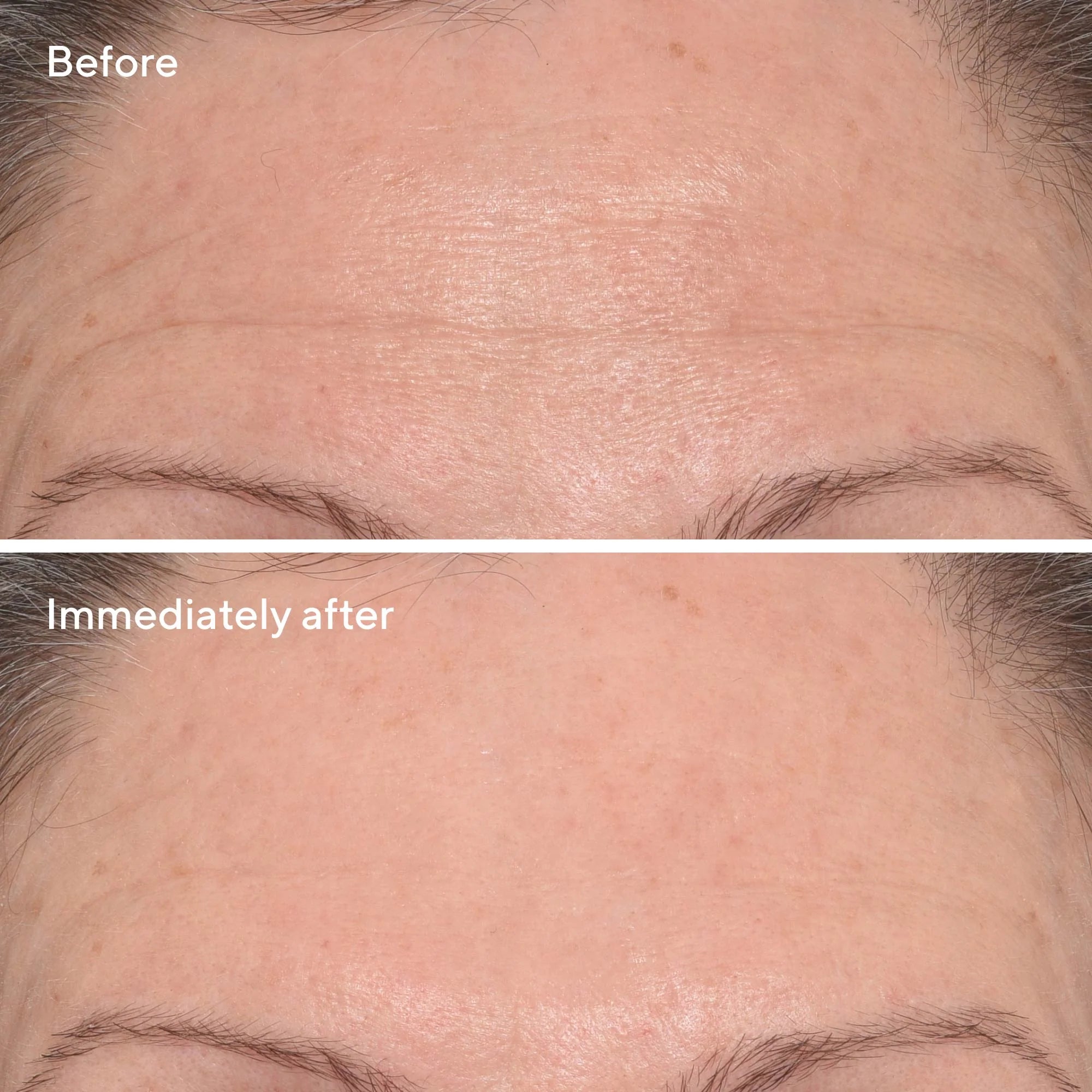 Targeted Wrinkle Corrector - Corrector de arrugas puntual ideal patas de gallo y código de barras