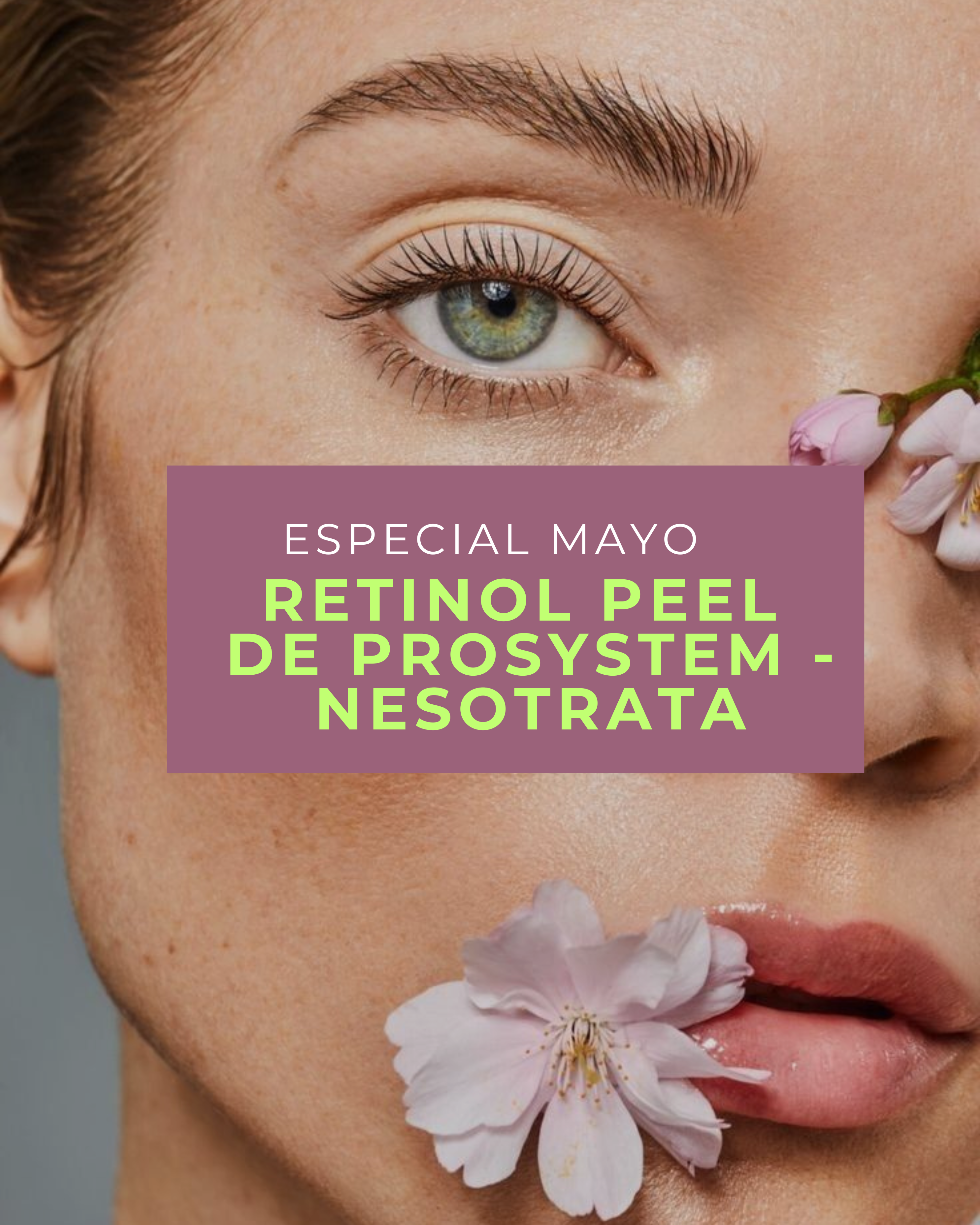 Retinol Peel: renovación profunda para arrugas, marcas, cicatrices y piel visiblemente rejuvenecida (1 sesión)