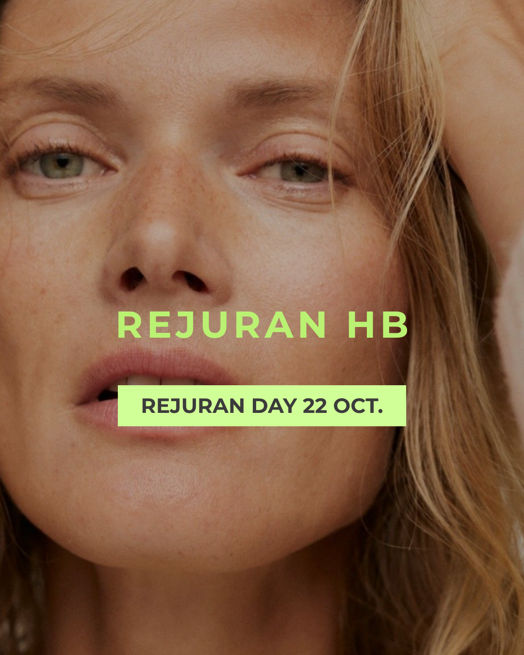 REJURAN HB – HIDRATA Y DA GLOW: (TODA LA CARA) EL ADN DE SALMÓN CON ÁCIDO HIALURÓNICO PARA UNA PIEL JUGOSA, ELÁSTICA Y LUMINOSA
