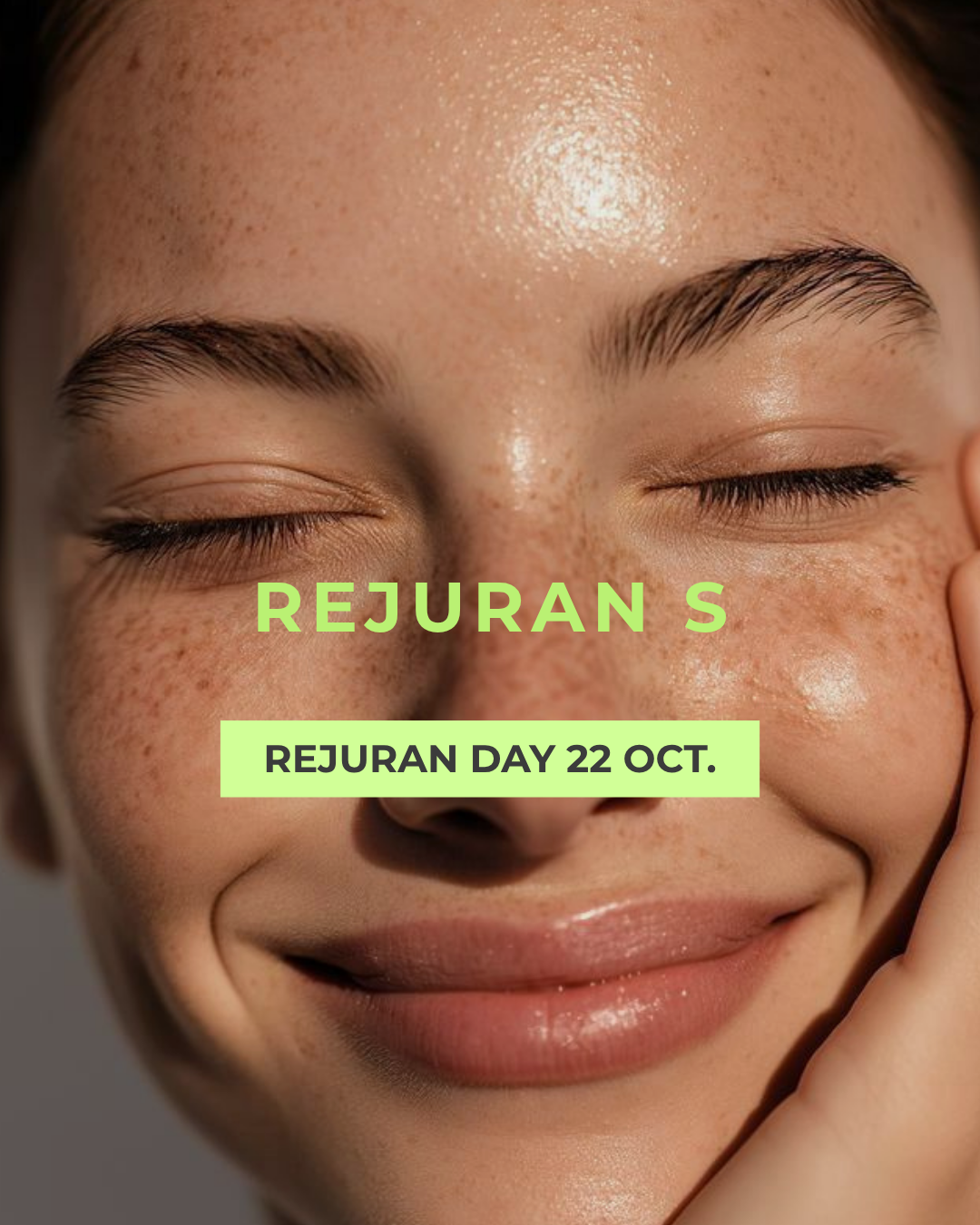 Rejuran S: (se aplica en zona de cicatrices o arrugas puntuales) El ADN de salmón de alta potencia que regenera la piel con cicatrices como las de acné y devuelve una textura lisa y uniforme