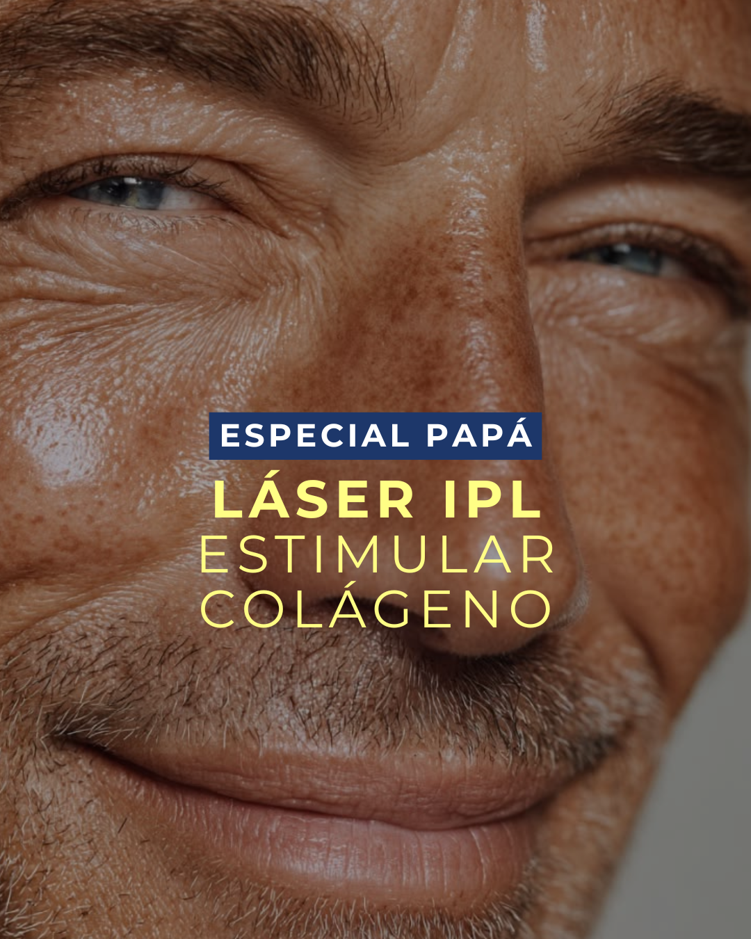 Láser IPL Antiage para Hombres (1 sesión): estimula tu propio colágeno, reduce arrugas y renueva tu piel sin cirugía ni tiempo de recuperación