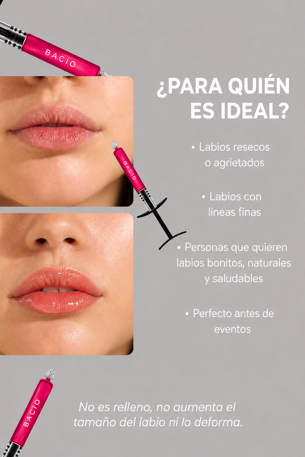 NUEVO TRATAMIENTO: BACIO - Mesoterapia que revitaliza e hidrata los labios resecos y agrietados sin cambiar la forma.