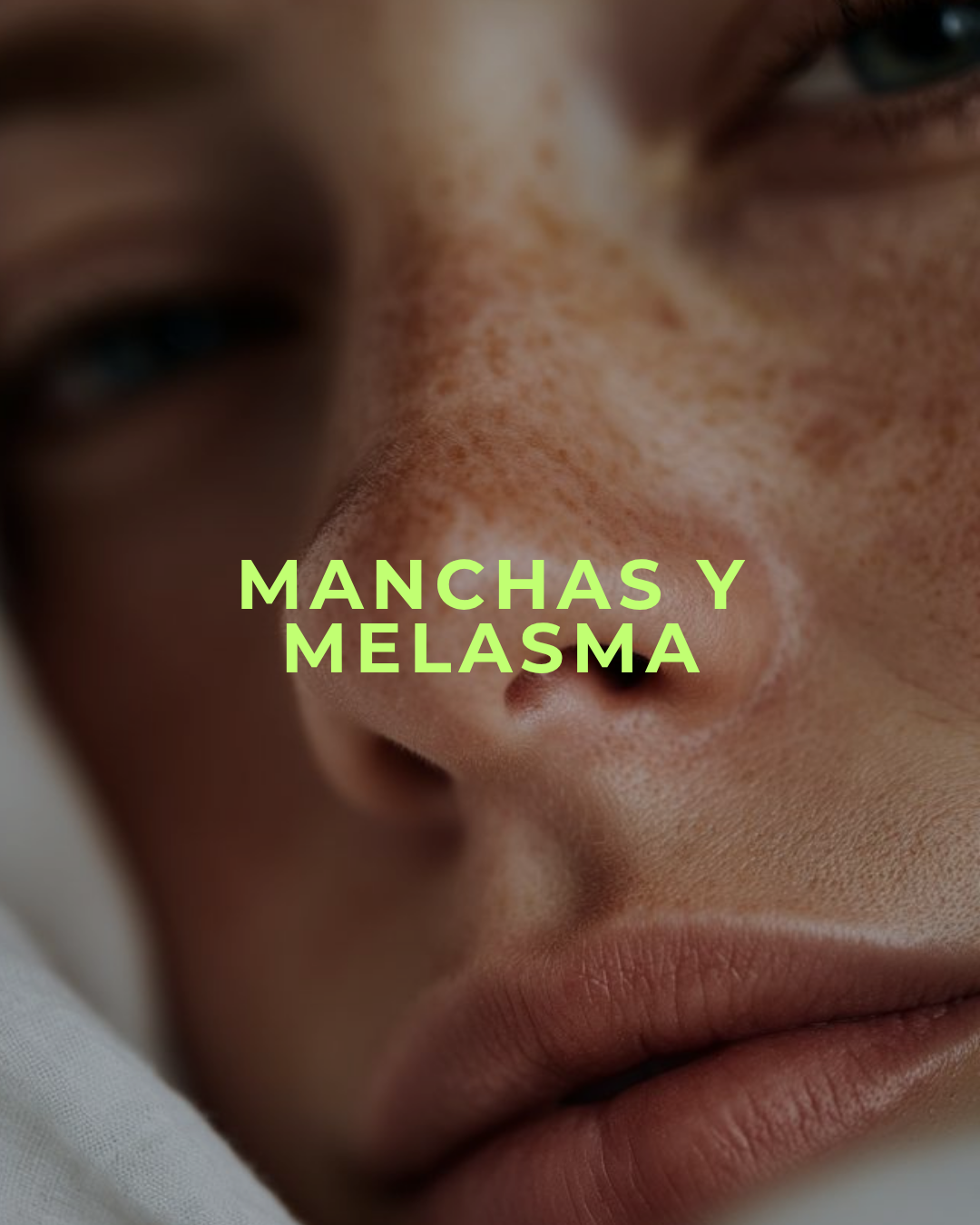 Precio Lanzamiento!!!! NUDE MELANOPEEL de mccosmetics / Peeling Anti-Manchas de Renovación – Piel Más Uniforme y Luminosa ✨ (+ 2 Productos para la casa incluidos que siguen tratamiento por 2-3 meses)