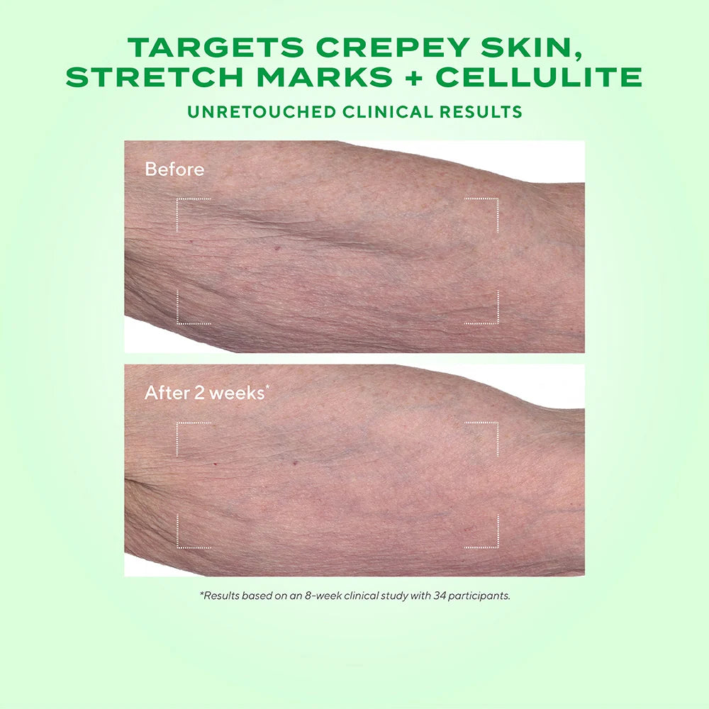 Retinal ReSculpt Body Treatment - Crema corporal reafirma y tensa la piel flácida y deshidratada