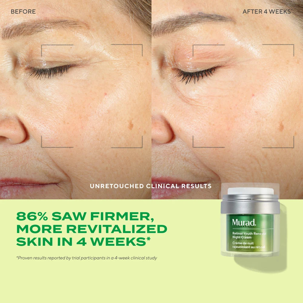 Retinol Youth Renewal Night Cream - Crema de noche con Retinol para arrugas