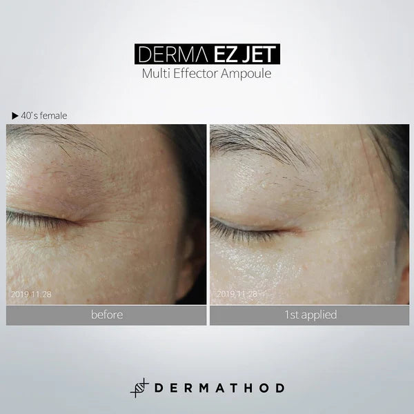 Dermathod DermaEZ Jet Multi Effector Ampoule - Tratamiento microneedle para regenerar y revitalizar la piel