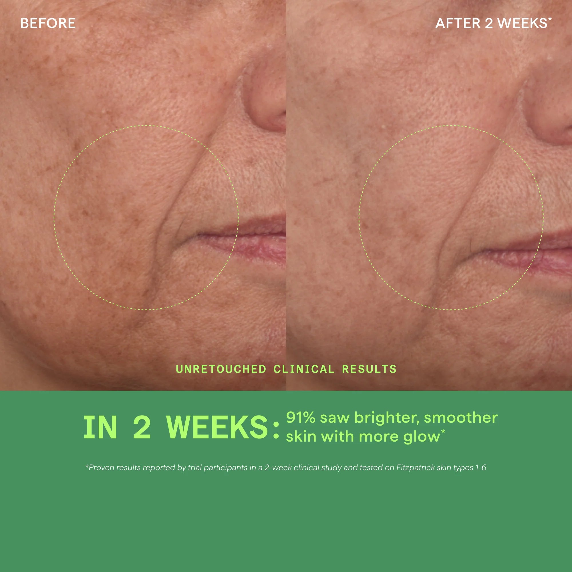 Vita-C Glycolic Serum - Sérum de Vitamina C + Ácido Glicólico