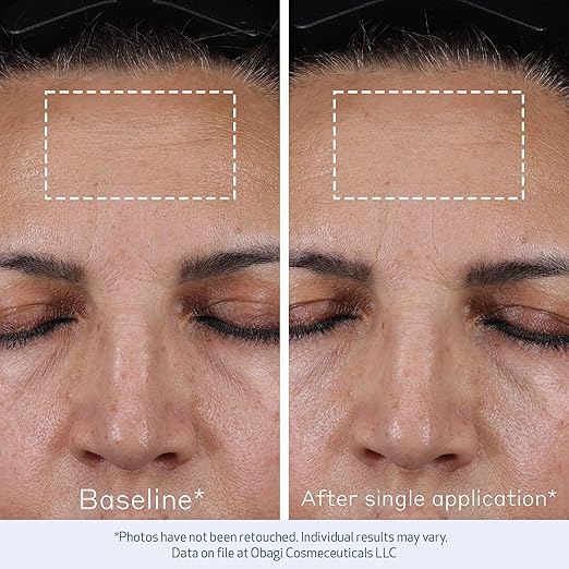 Elastiderm® Advanced Filler Concentrate - serum con potente péptido biomimético conocido por sus efectos rellenadores y suavizantes de arrugas.