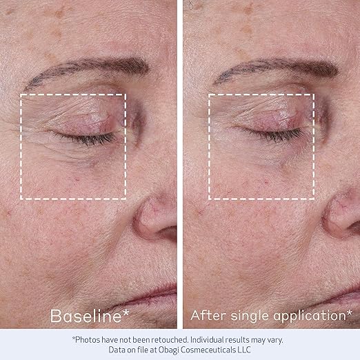 Elastiderm® Advanced Filler Concentrate - serum con potente péptido biomimético conocido por sus efectos rellenadores y suavizantes de arrugas.