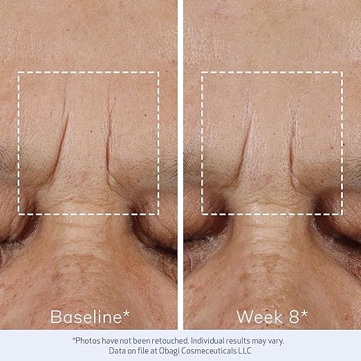 Elastiderm® Advanced Filler Concentrate - serum con potente péptido biomimético conocido por sus efectos rellenadores y suavizantes de arrugas.