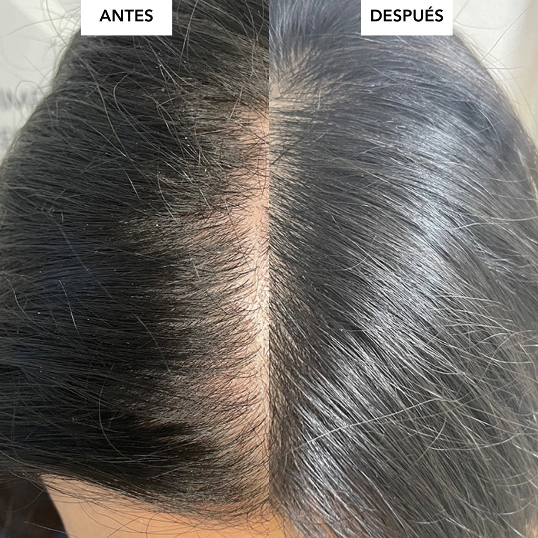 Spray Keravive - Tratamiento Capilar para fortalecer, hidratar y ayudar al crecimiento natural del cabello