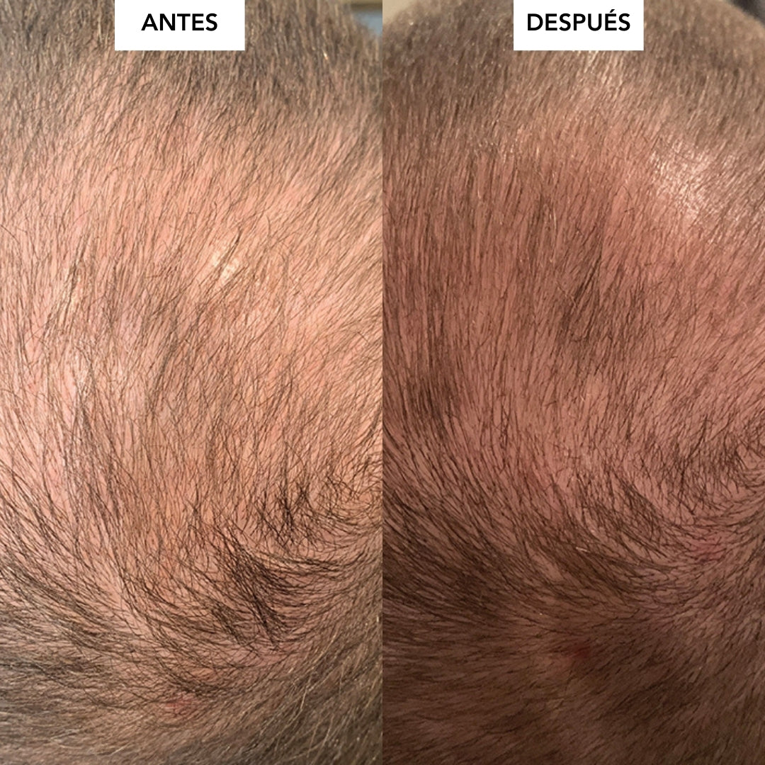 Spray Keravive - Tratamiento Capilar para fortalecer, hidratar y ayudar al crecimiento natural del cabello