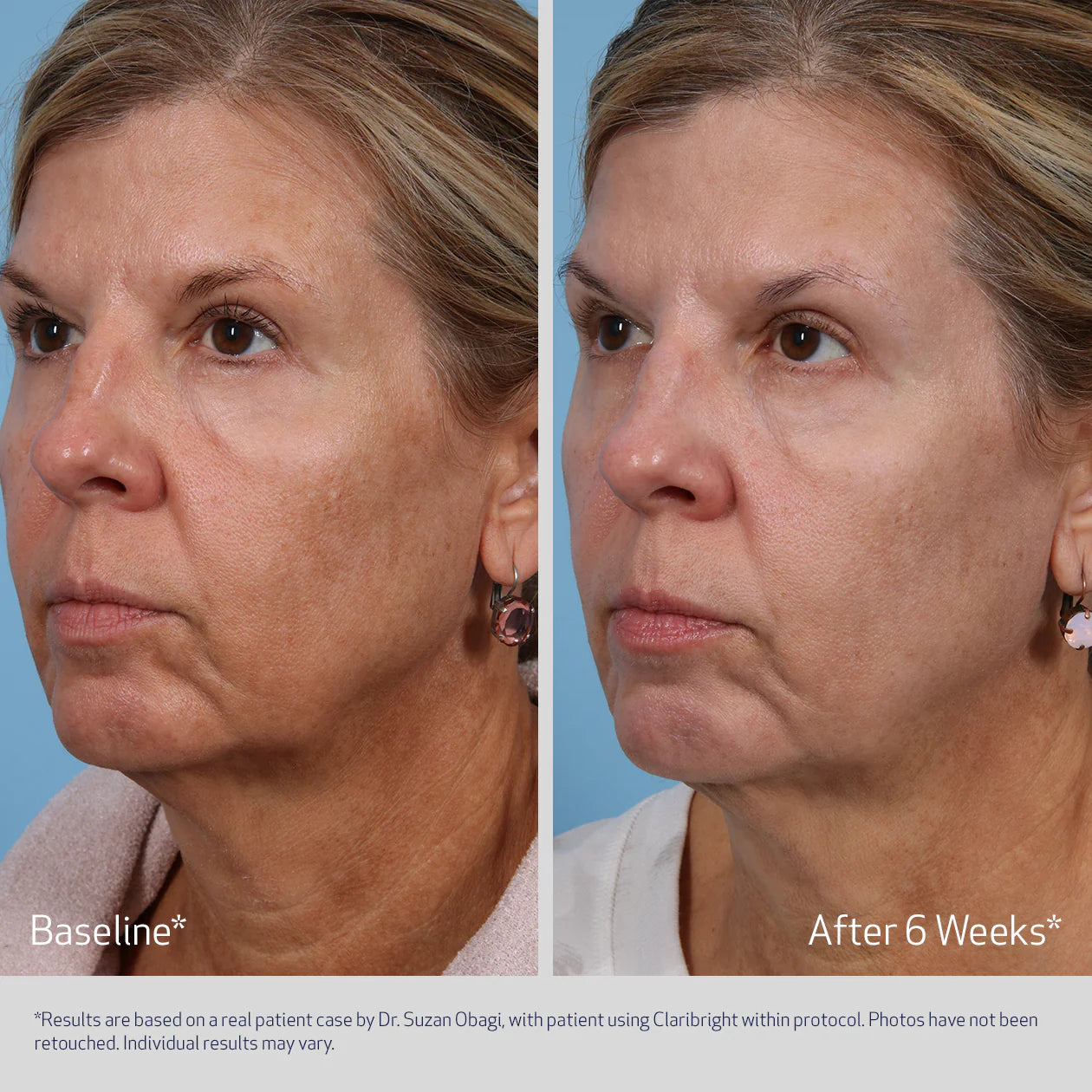 Claribright Radiance Brightening Lotion - Loción Iluminadora Radiance