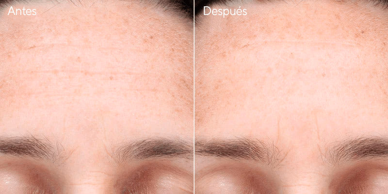 Multi-Vitamin Infusion Oil - Serum nutritivo en aceite no comedogénico y logra efecto de brillo