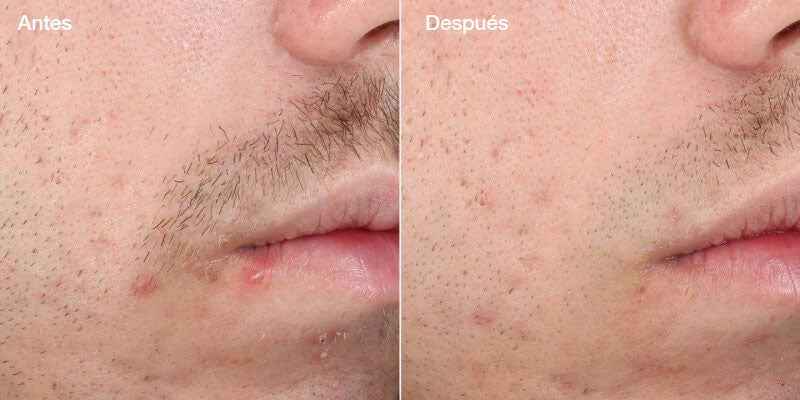 Outsmart Blemish Clarifying Treatment - Serum tratamiento antibrotes y antimanchas