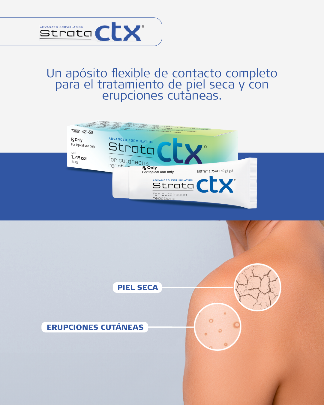 StrataCTX - Gel no esteroidal para piel seca y reacciones cutáneas