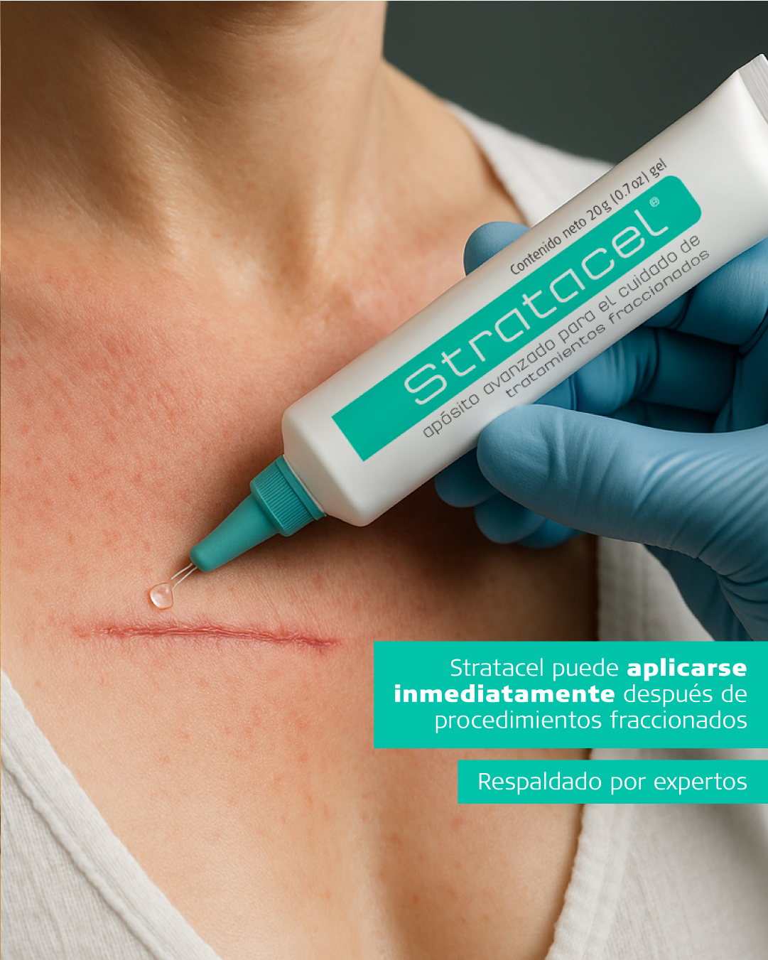 Stratacel - Gel Reparador Post Procedimiento | Cuidado Post Láser