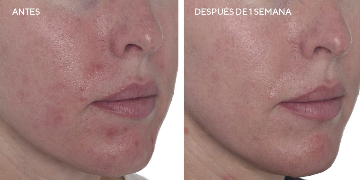 Cellular Hydration Repair Face Oil Drops - Aceite facial de rápida absorción para hidratar e iluminar tu piel