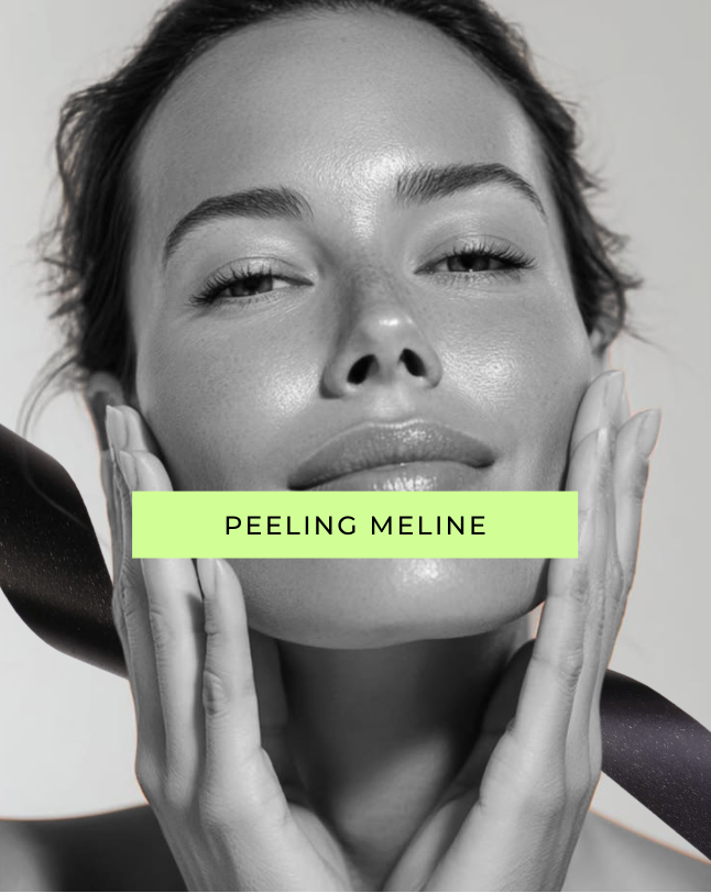 Peeling Meline: el tratamiento especializado que borra manchas, melasma y pigmentación irregular para una piel más uniforme y luminosa (1 sesión)