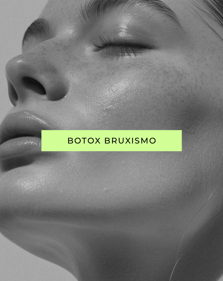Toxina Botulínica para Bruxismo: relaja la mandíbula, alivia el dolor y mejora la armonía de tu rostro sin cirugía