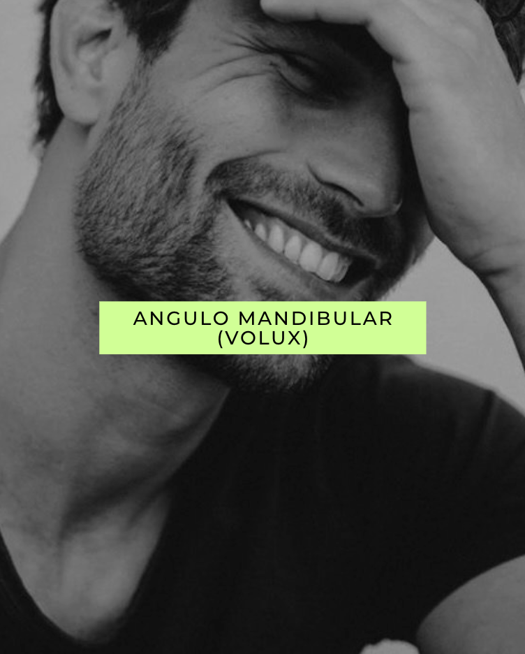 Ángulo Mandibular: el tratamiento que define, estructura y armoniza tu rostro de forma natural y sin cirugía