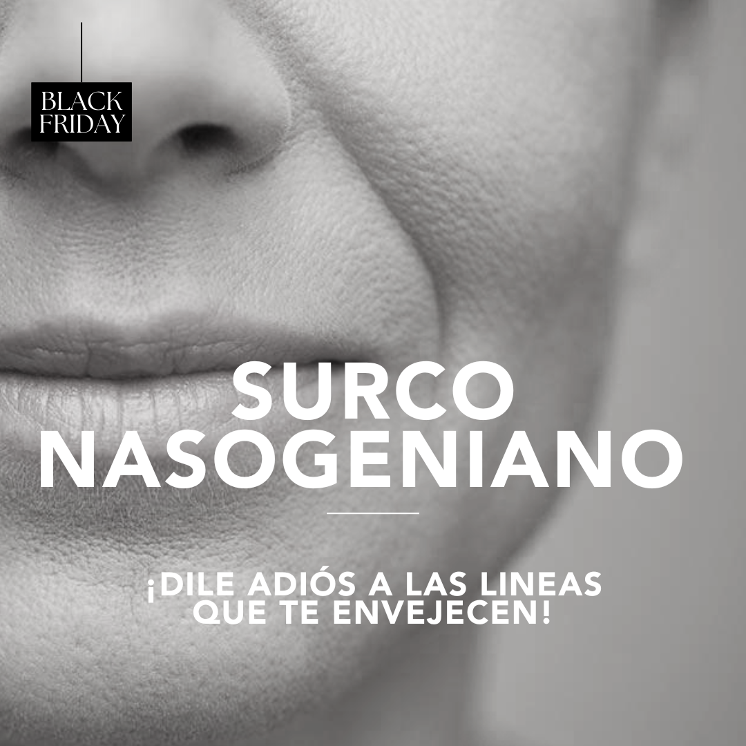 Surco Nasogeniano y marioneta ¡Dile adiós a lineas que te envejecen! Descuento Black Noviembre 2025