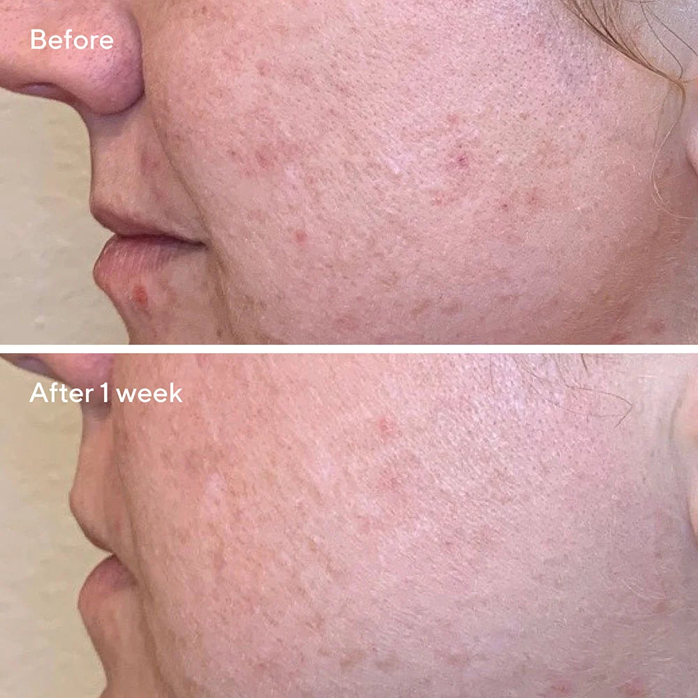 Daily Clarifying Peel - Peeling alisante para poros