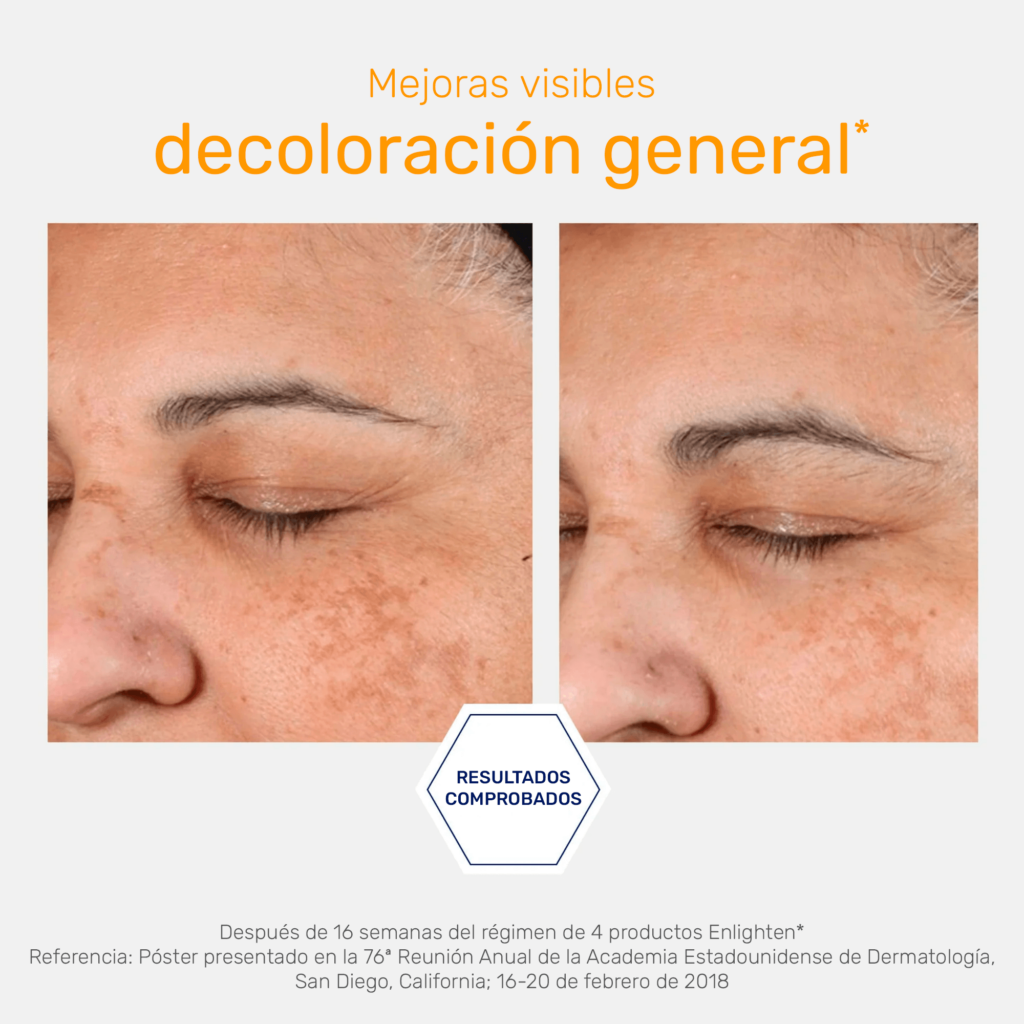 Illuminating Serum - Serum despigmentante Iluminador