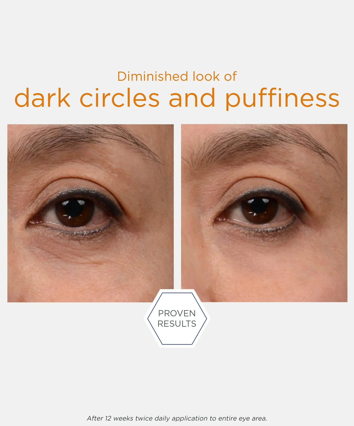 Brightening Eye Cream - Crema Corrección de ojeras hiperpigmentadas y antiarrugas