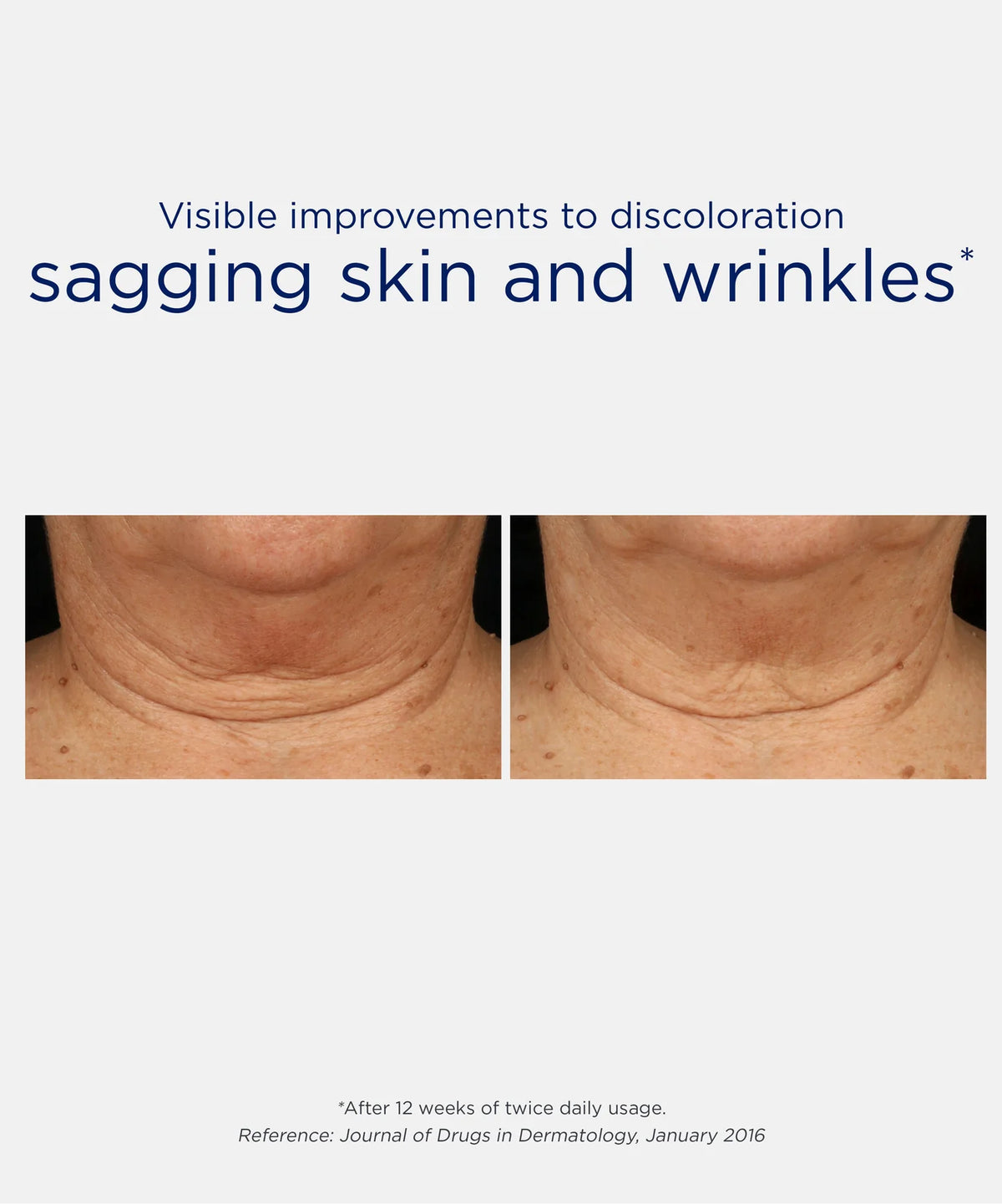 Triple Firming Neck MDP Cream - Crema para cuello y escote con efecto lifting ★ BEST UP ★