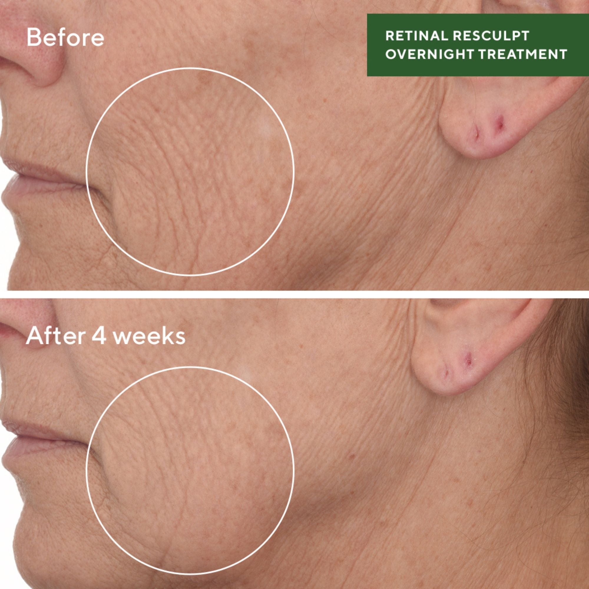 Retinal ReSculpt™ Overnight Treatment - Tratamiento de noche antienvejecimiento y firmeza ★ BEST UP ★