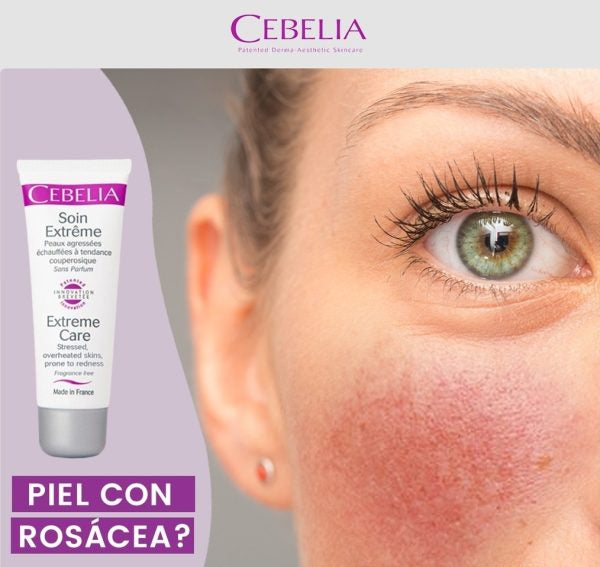 Soin Extreme - Crema calmante y antienrojecimiento para pieles ENROJECIDAS ★ BEST UP ★