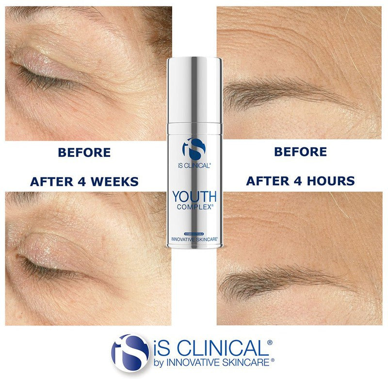 Youth Eye Complex / contorno de ojos rejuvenecedor con péptidos y factores de crecimiento
