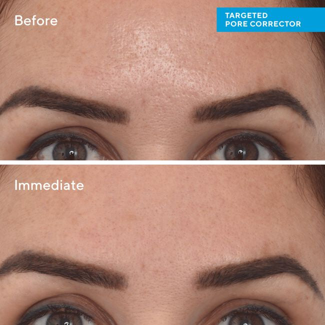 Targeted Pore Corrector - Corrector de Poros