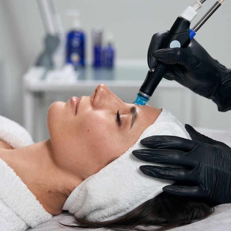 Hydrafacial Tratamiento 4 en 1 - Limpia, Hidrata, Da brillo, Despigmenta permitido en embarazadas