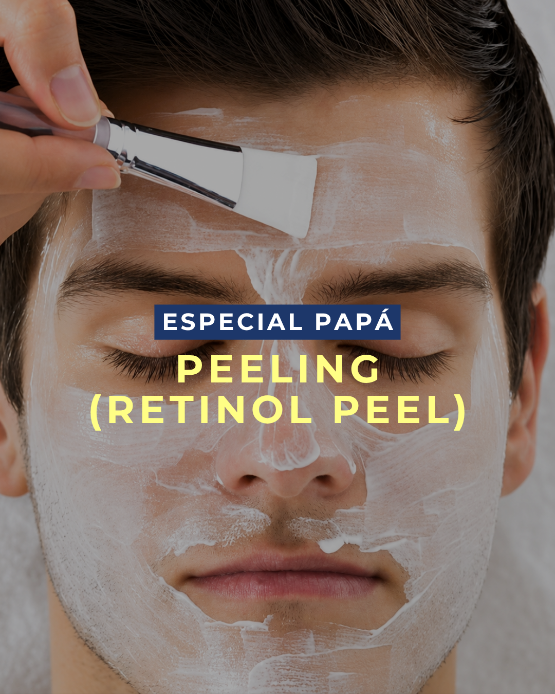 Retinol Peel para Hombres: el peeling profesional que renueva tu piel, reduce el acné y combate las arrugas sin drama ni complicaciones