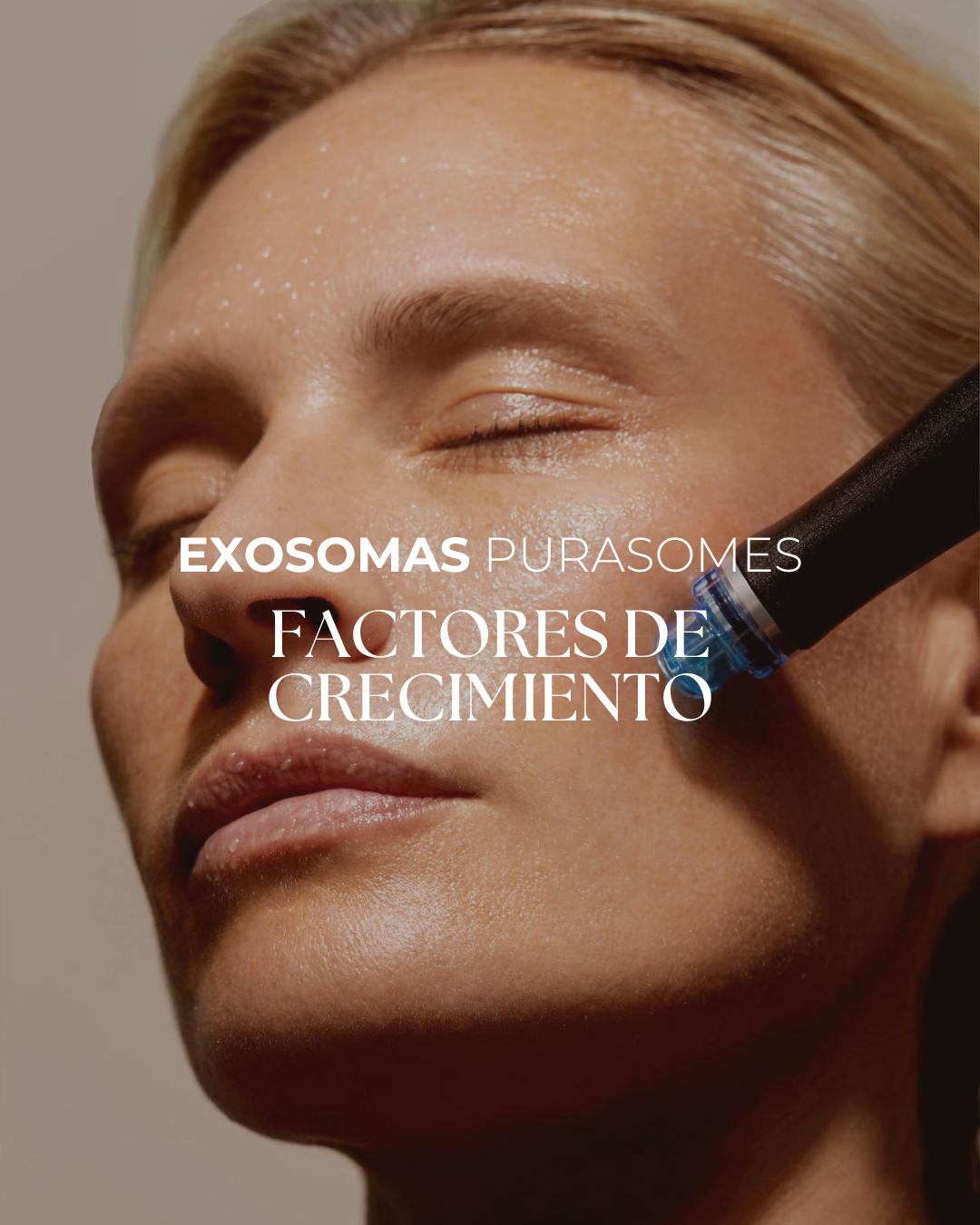PURASOMES · Exosomas + factores de crecimiento con Dermapen — para piel más firme, más luminosa y con mejor calidad desde la primera sesión