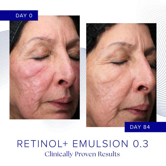 Retinol+ Emulsion 0.3 Is Clinical - Antiedad, atenua, ilumina