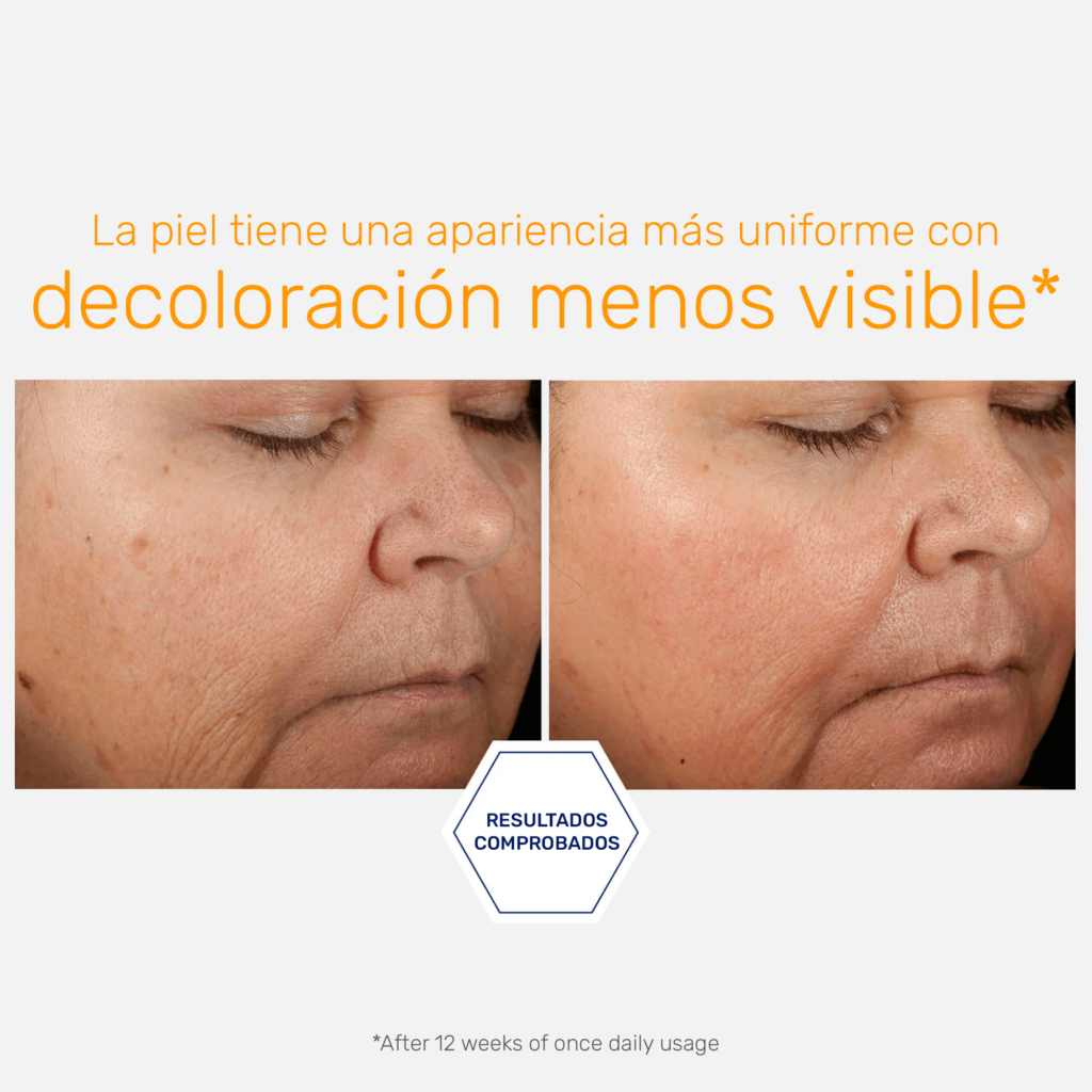 Serum 15% Vitamin C+ PHA - Serum Antioxidante Despigmentante Uso AM