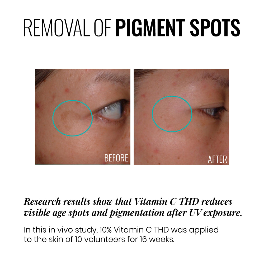 Anti-Wrinkle Brightening C-ERUM - Serum antioxidante antienvejecimiento Iluminador con vit c 15% + niacinamida 5% ★ BEST UP ★