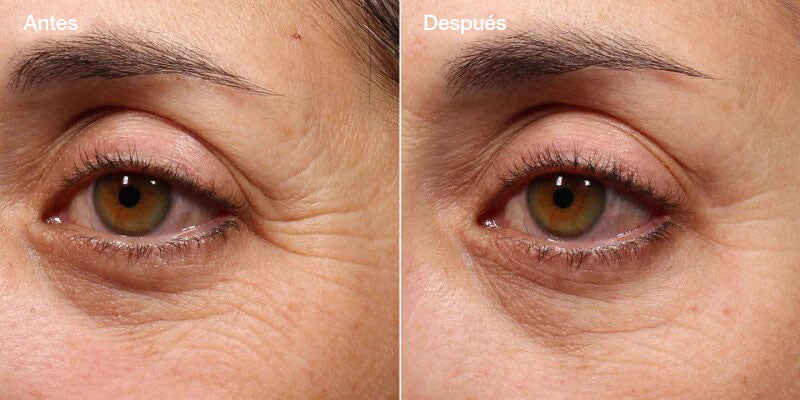 Retinol Youth Renewal Eye Serum - Contorno de ojos con retinol antiarrugas