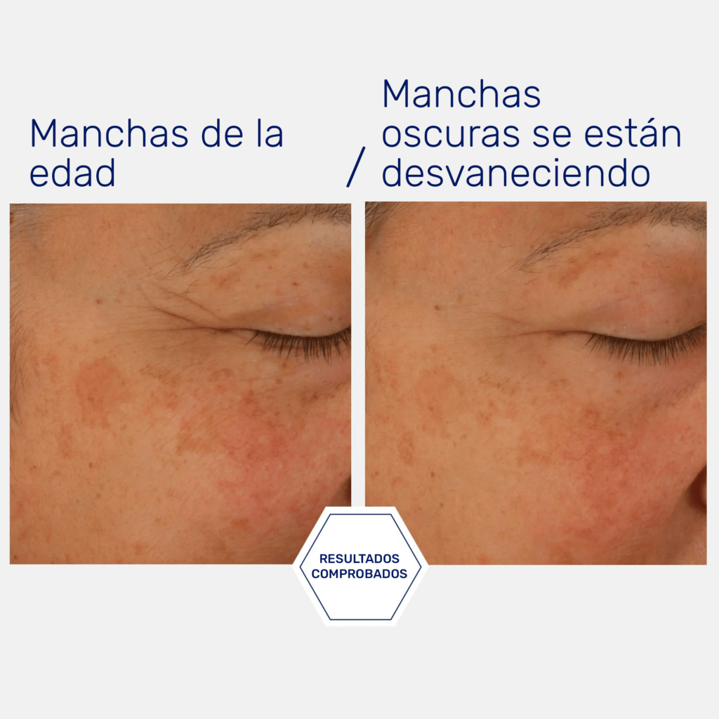 Potent Retinol Complex / serum de Retinol con liberación sostenida amable con la piel ★ BEST UP ★