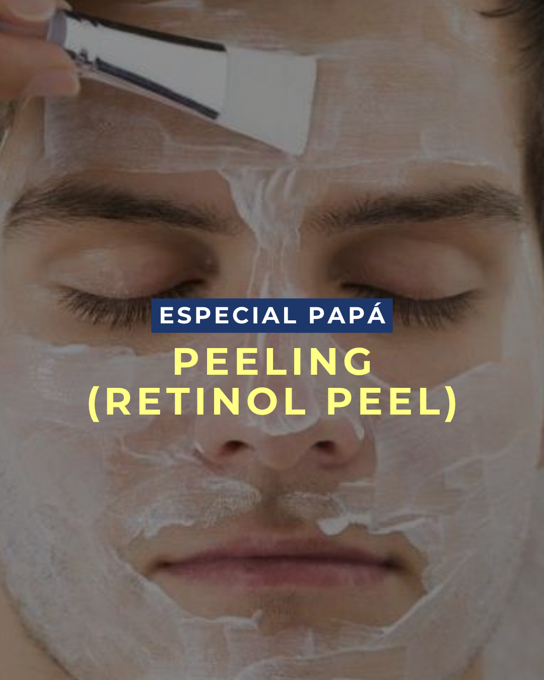Retinol Peel para Hombres: el peeling profesional que renueva tu piel, reduce el acné y combate las arrugas sin drama ni complicaciones