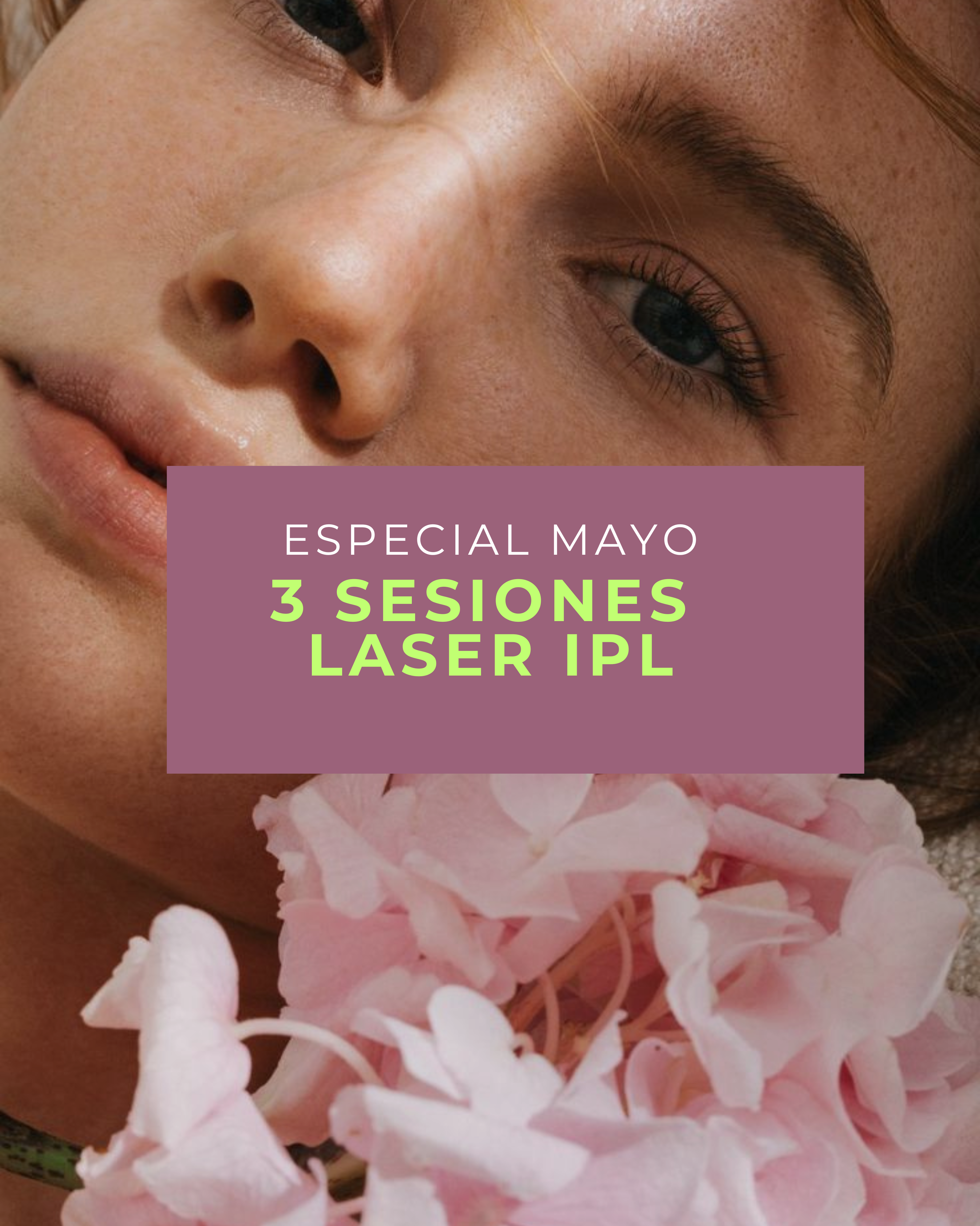 3 sesiones de Láser IPL: mejora manchas solares, rojeces, tono disparejo y luminosidad