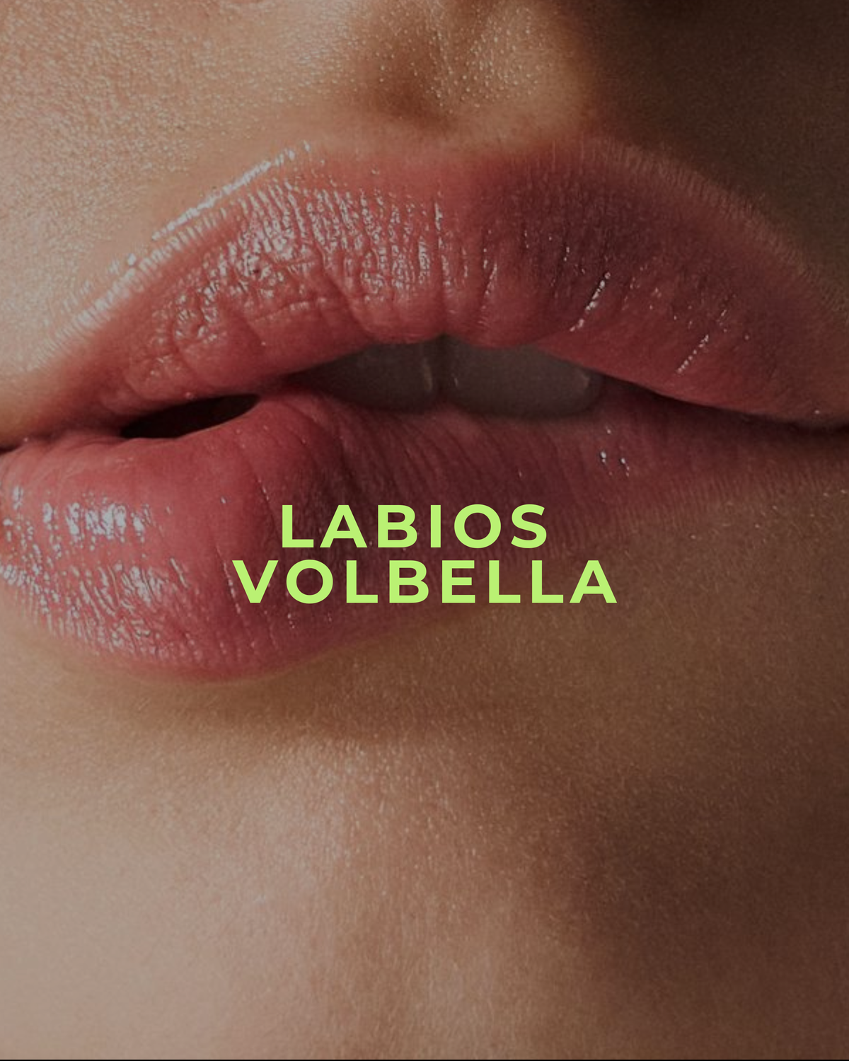 LABIOS VOLBELLA: El relleno de ácido hialurónico que hidrata en profundidad y define tus labios para un resultado natural e irresistible