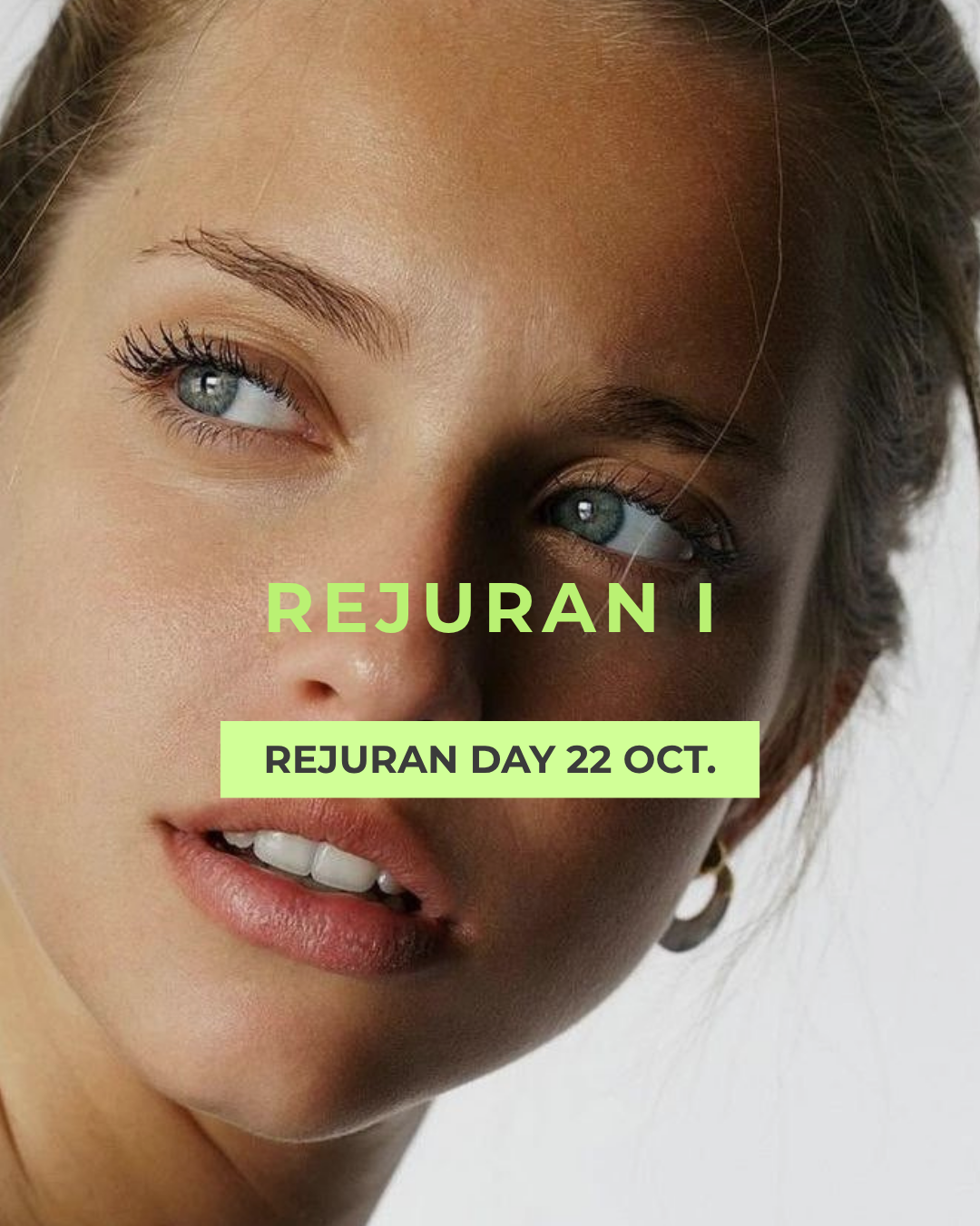 REJURAN i: (se aplica en ojeras para mejorar arrugas, flacidez y color) El ADN de salmón de alta precisión que regenera el contorno de ojos y devuelve luminosidad a tu mirada