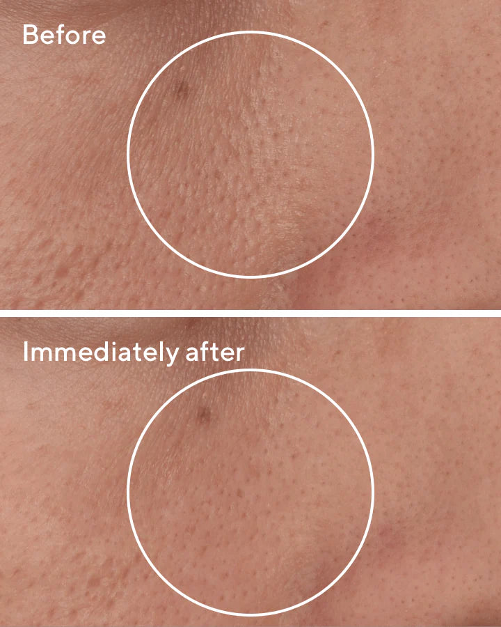 Targeted Pore Corrector - Corrector de Poros