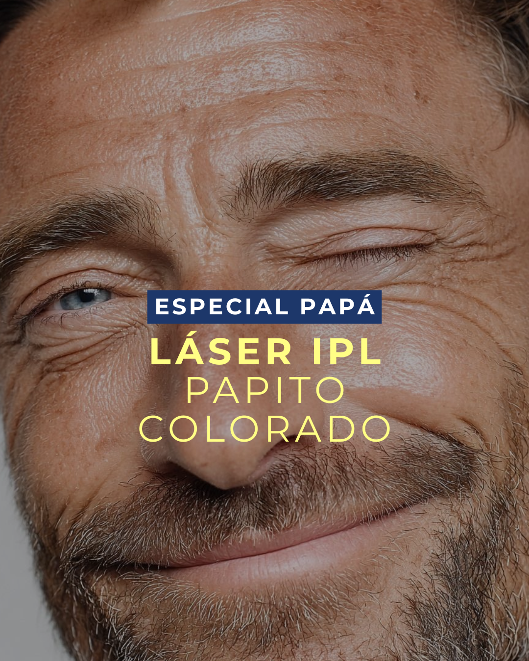 Láser IPL para Hombres (1 sesión): el tratamiento que elimina el enrojecimiento, la rosácea y las arañitas vasculares del rostro — el regalo perfecto para el Día del Papá