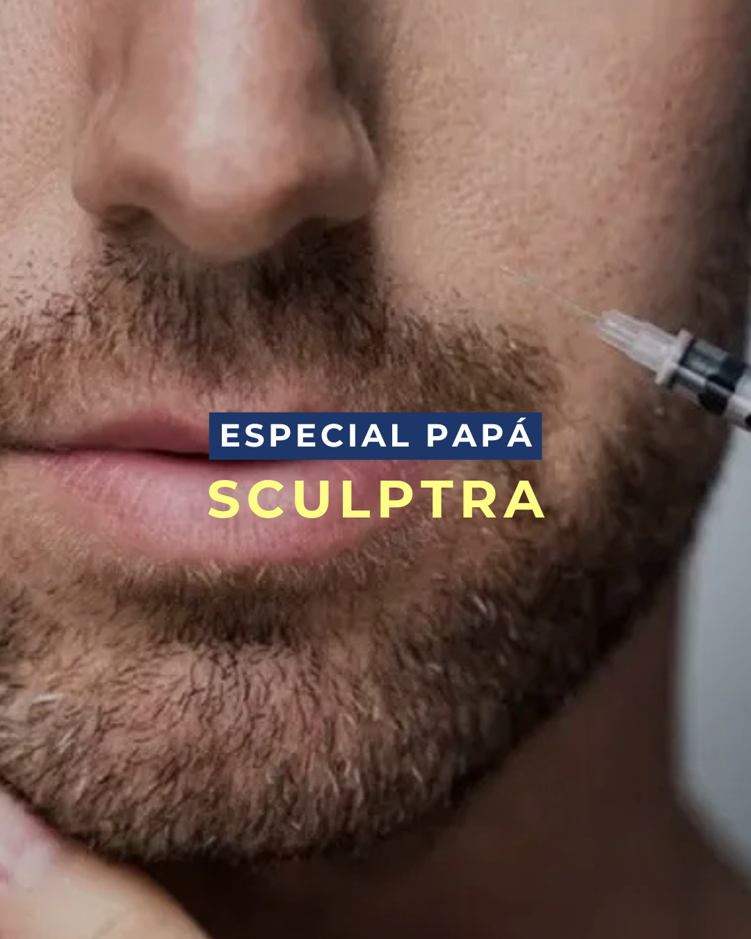 Sculptra: el bioestimulador de ácido poliláctico que reconstruye el colágeno de tu rostro desde adentro con resultados naturales y duraderos